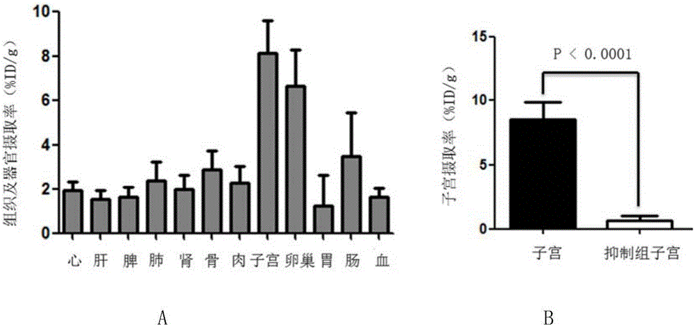 Receptor molecularly-targeted imaging agent and preparation method and application thereof