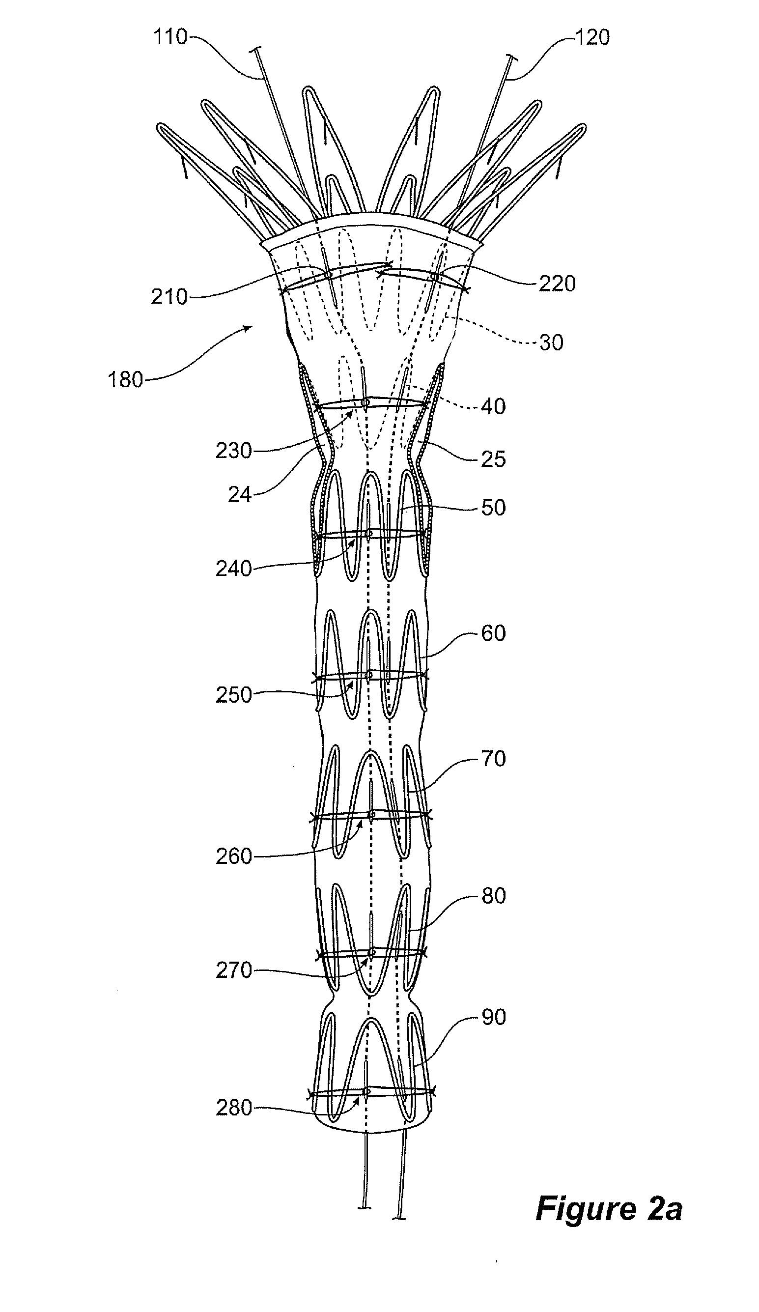 Assembly of stent grafts with diameter reducing ties