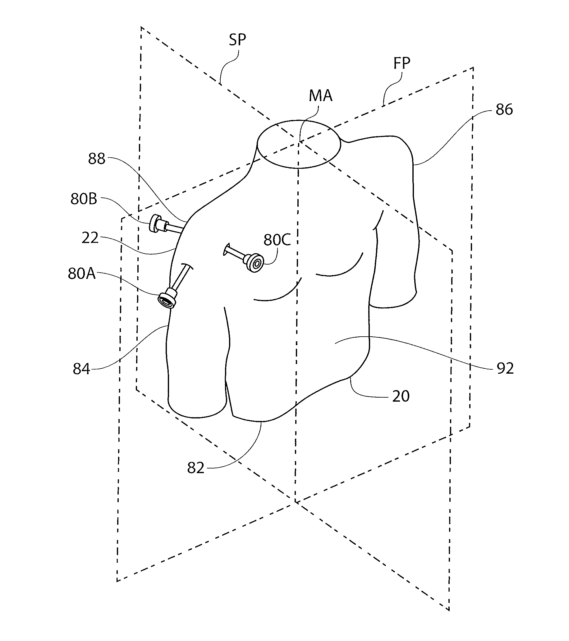 Anatomical location markers and methods of use in positioning sheet-like materials during surgery