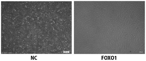 Method for directly transdifferentiating mesenchymal stem cells into sperms by using transcription factor FOXO1