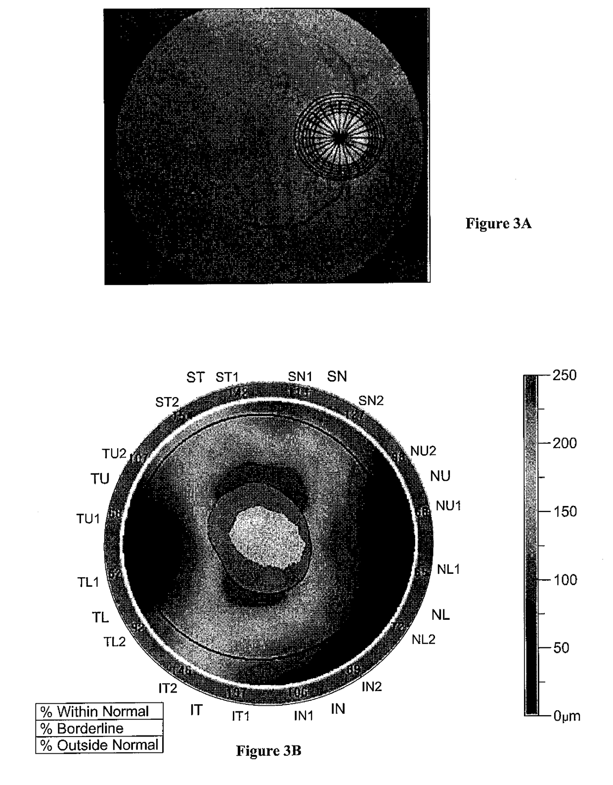 Methods for diagnosing glaucoma utilizing combinations of FD-OCT measurements from three anatomical regions of the eye