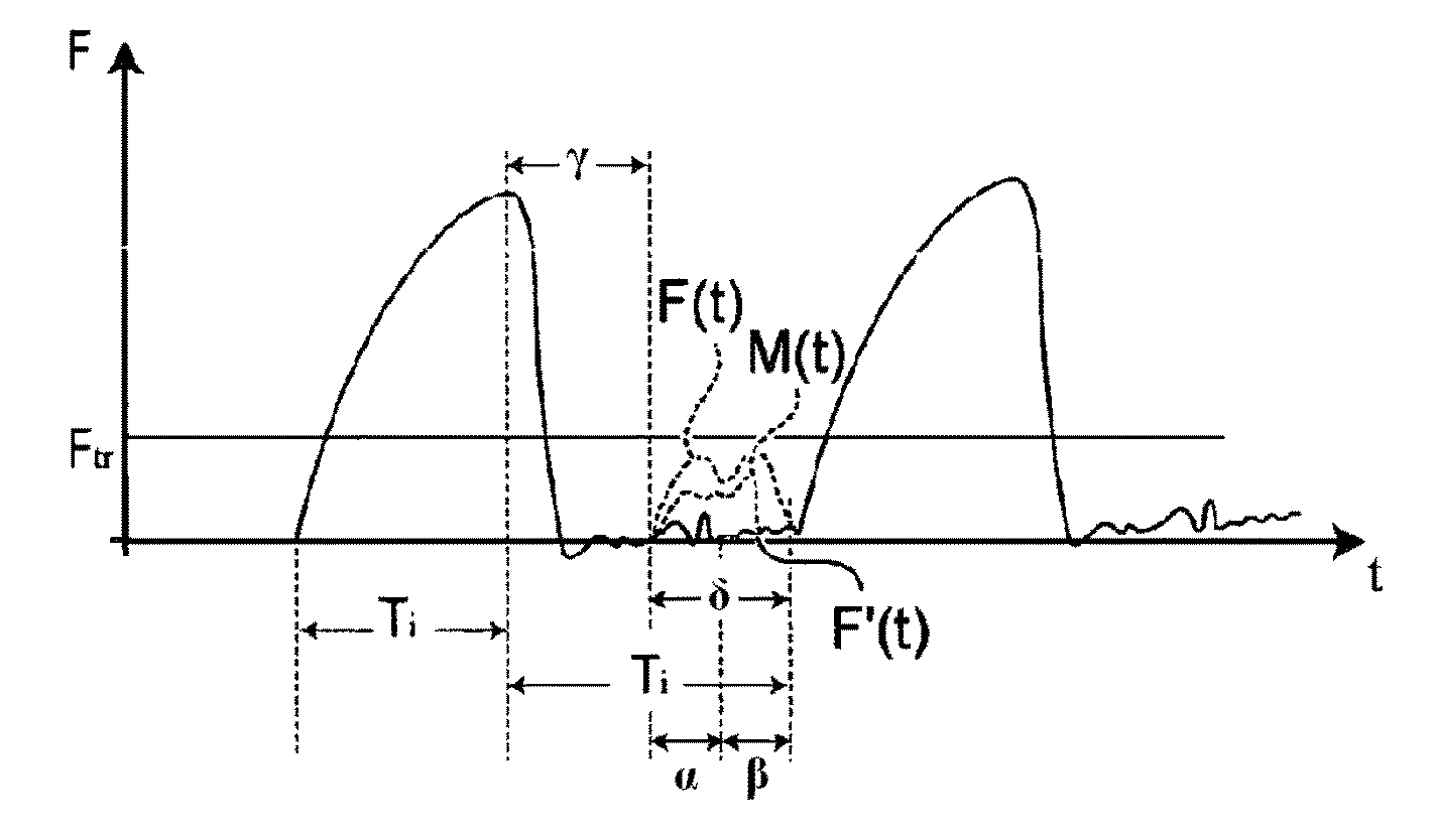 Method and relevant apparatus for nasal ventilation, particularly for flow-synchronised neonatal assisted ventilation