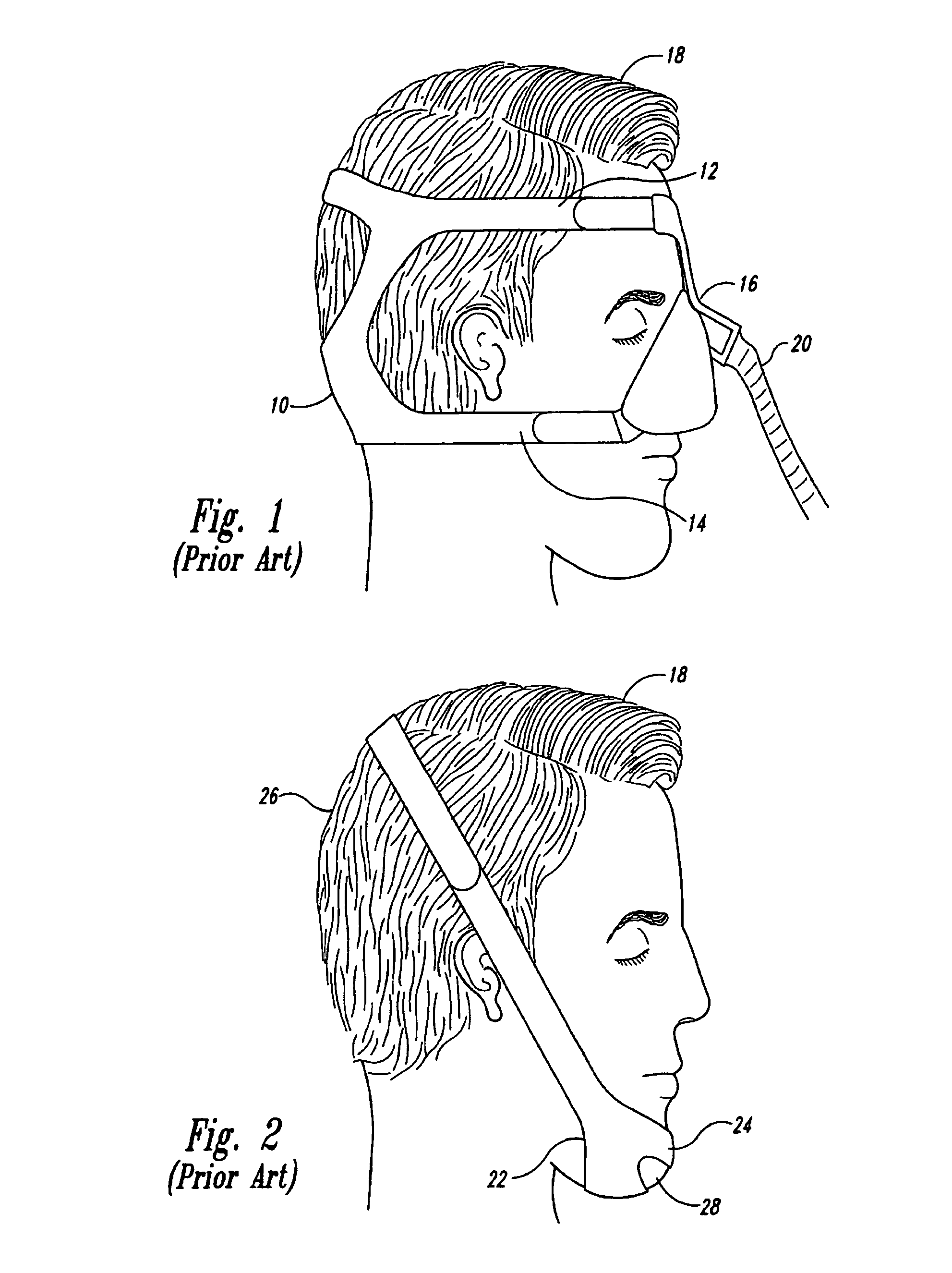 Headgear apparatus