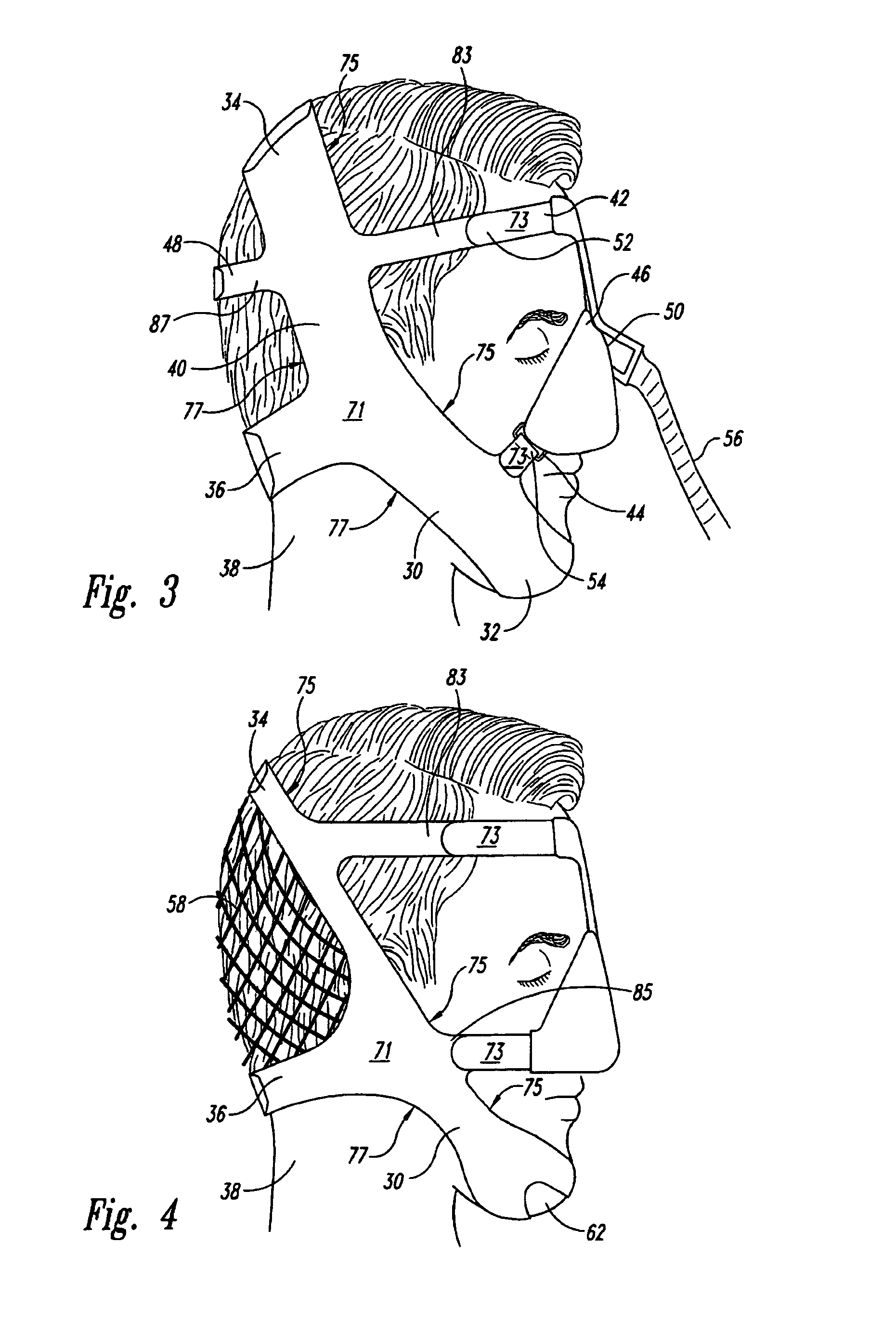 Headgear apparatus