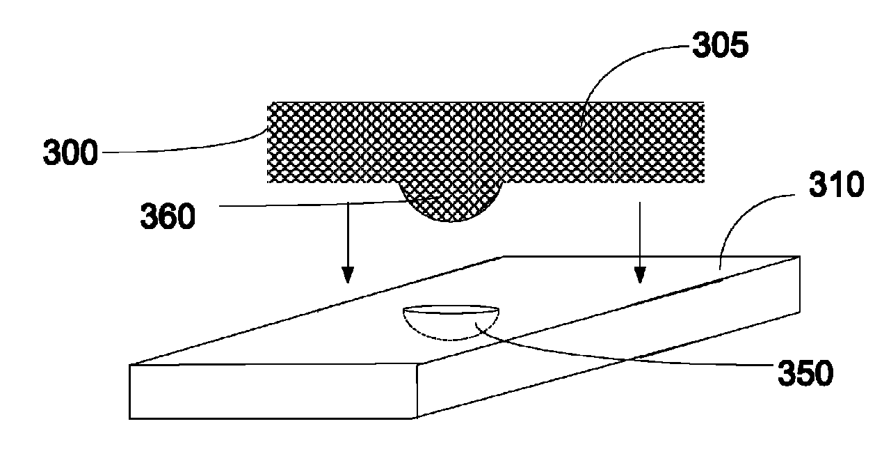 Anchor assembly for use in occipital nerve stimulation