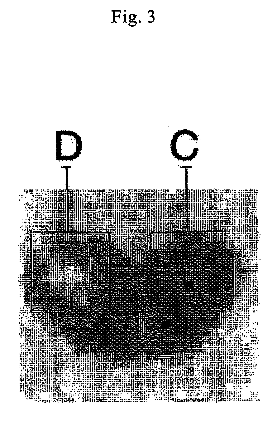 Diagnosis of prostate cancer