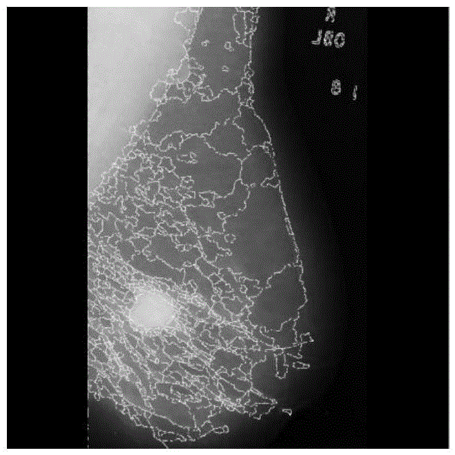 Medical Image Processing Method Based on Network Phase Synchronization