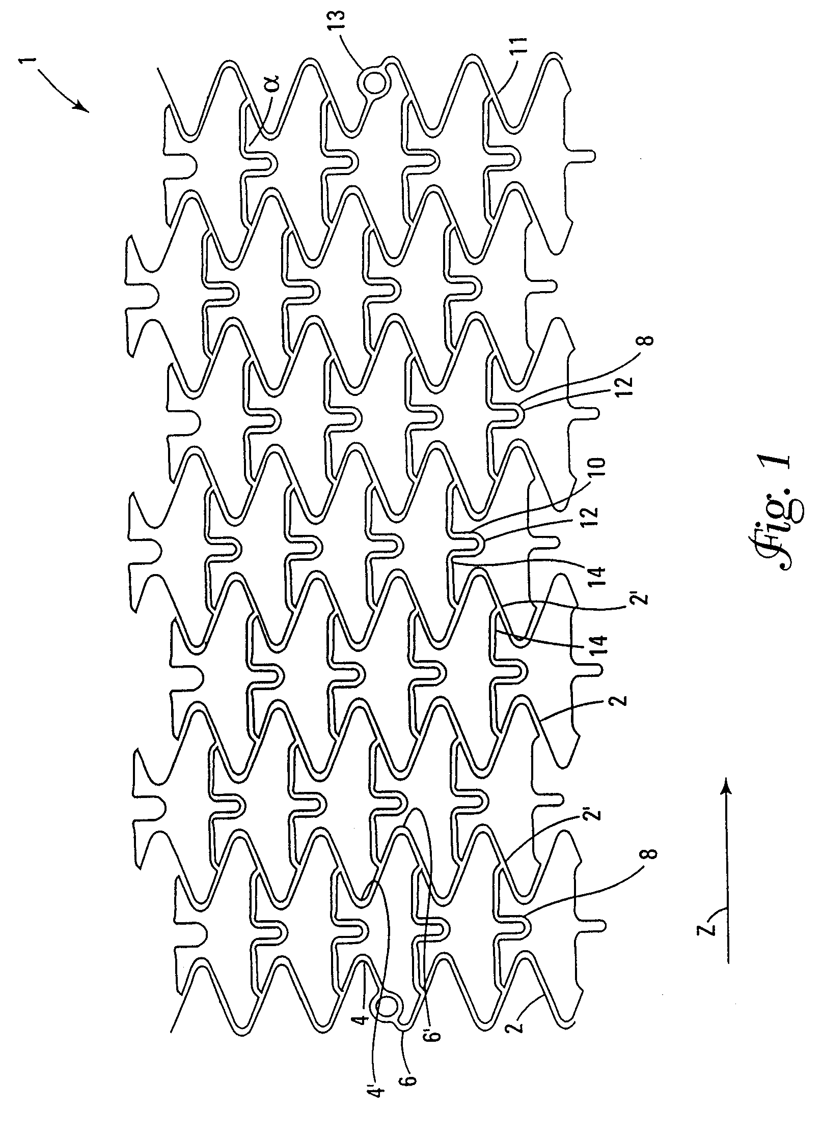 Stents for angioplasty