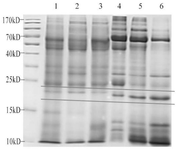 Urinary Protein Markers of Renal Injury in Malignant Hypertension and Its Diagnostic Application