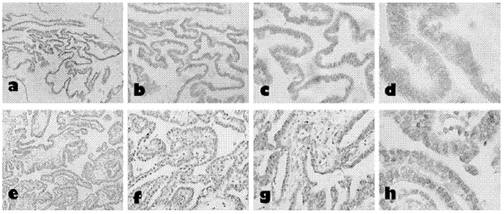 Kit used for evaluating ovarian cancer primary chemotherapeutic sensitivity, and application thereof