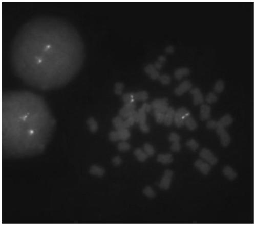 Leukemia MEF2D gene disruption probe detection kit