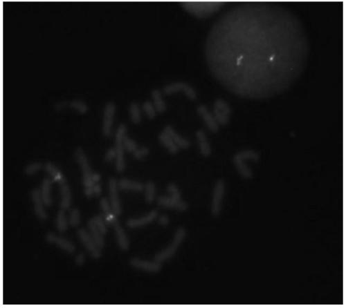 Leukemia MEF2D gene disruption probe detection kit