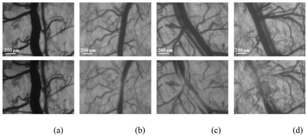 A hydrogen storage nano-palladium photothermal effect targeted release liposome functional group and its preparation method and application