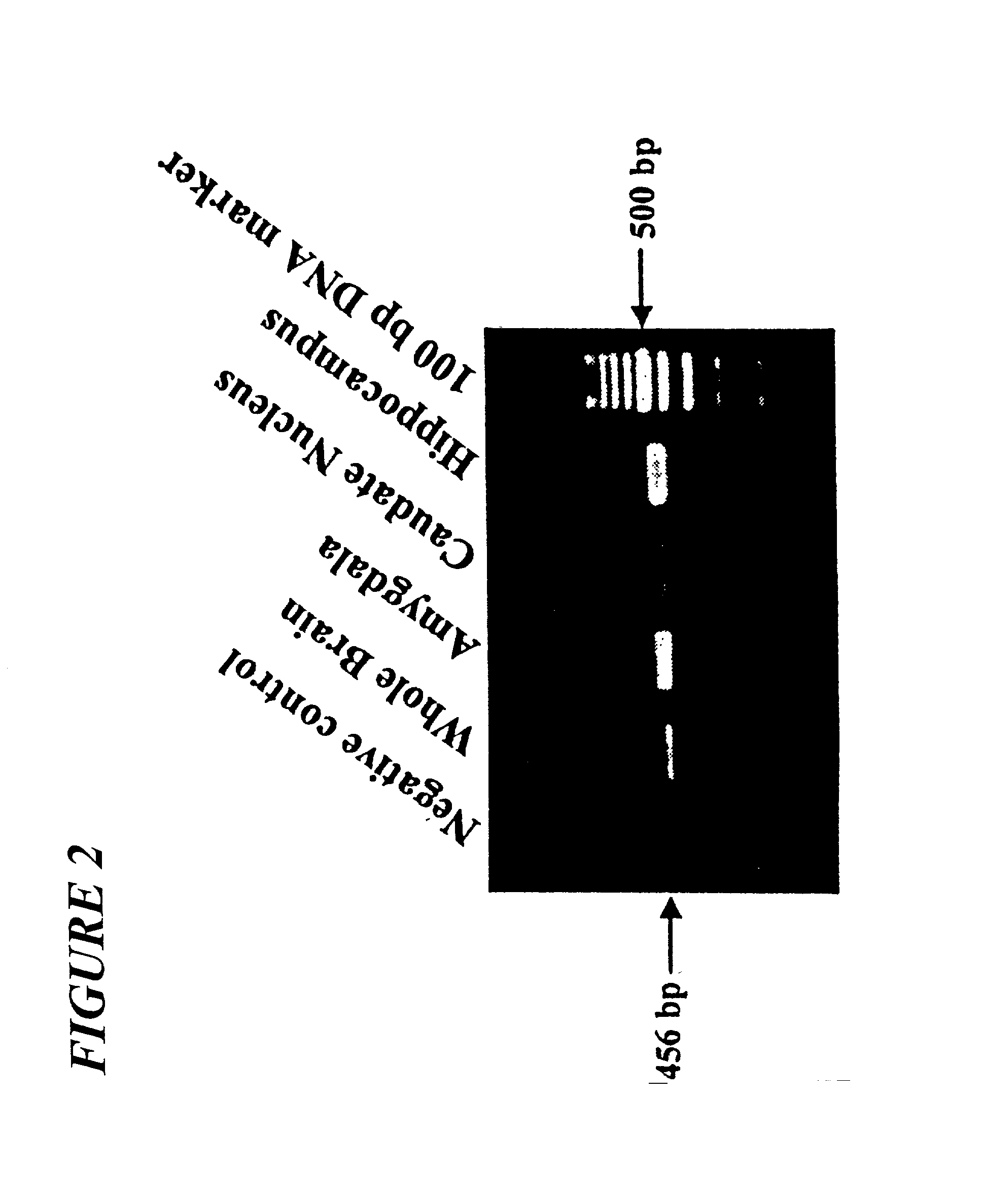 Novel primers for screening schizophrenia and a method thereof