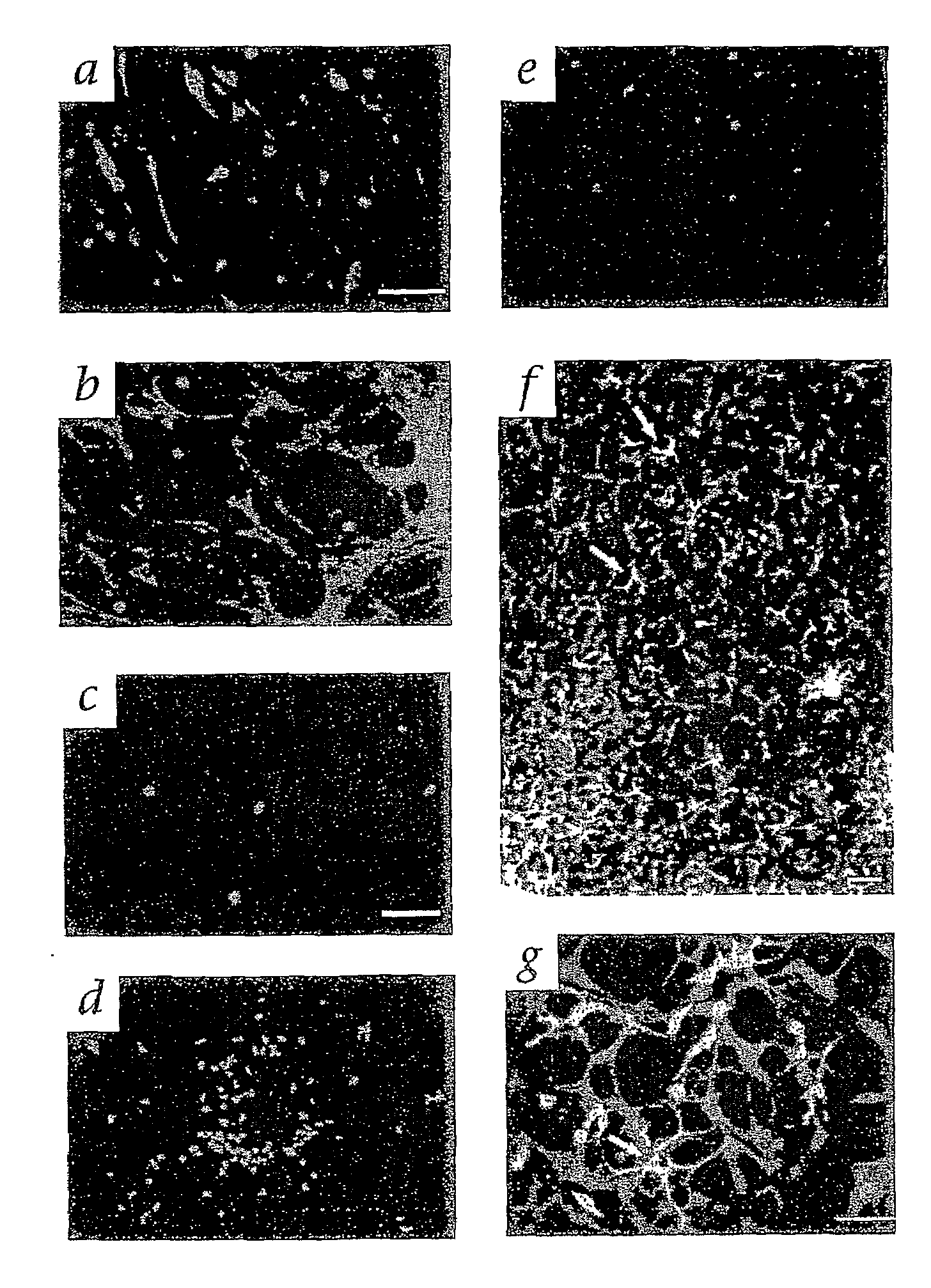 Method for the Treatment of Retinopathy of Prematurity and Related Retinopathic Diseases