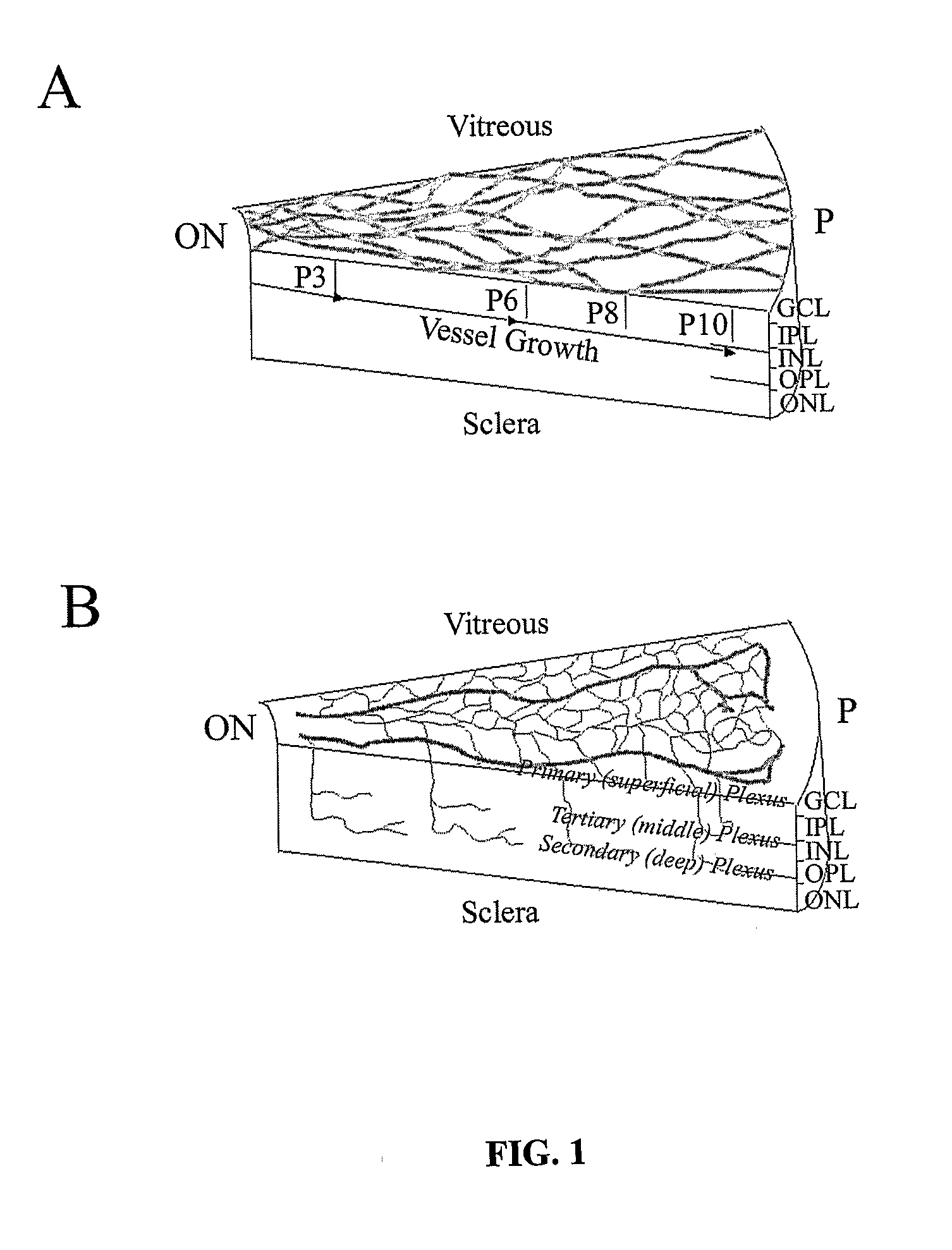 Method for the Treatment of Retinopathy of Prematurity and Related Retinopathic Diseases