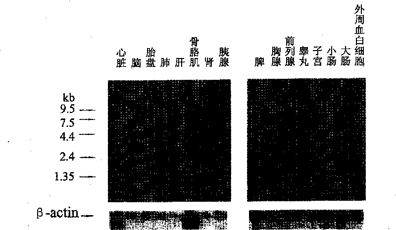 Application of BRSK2 in producing antidiabetic medicine