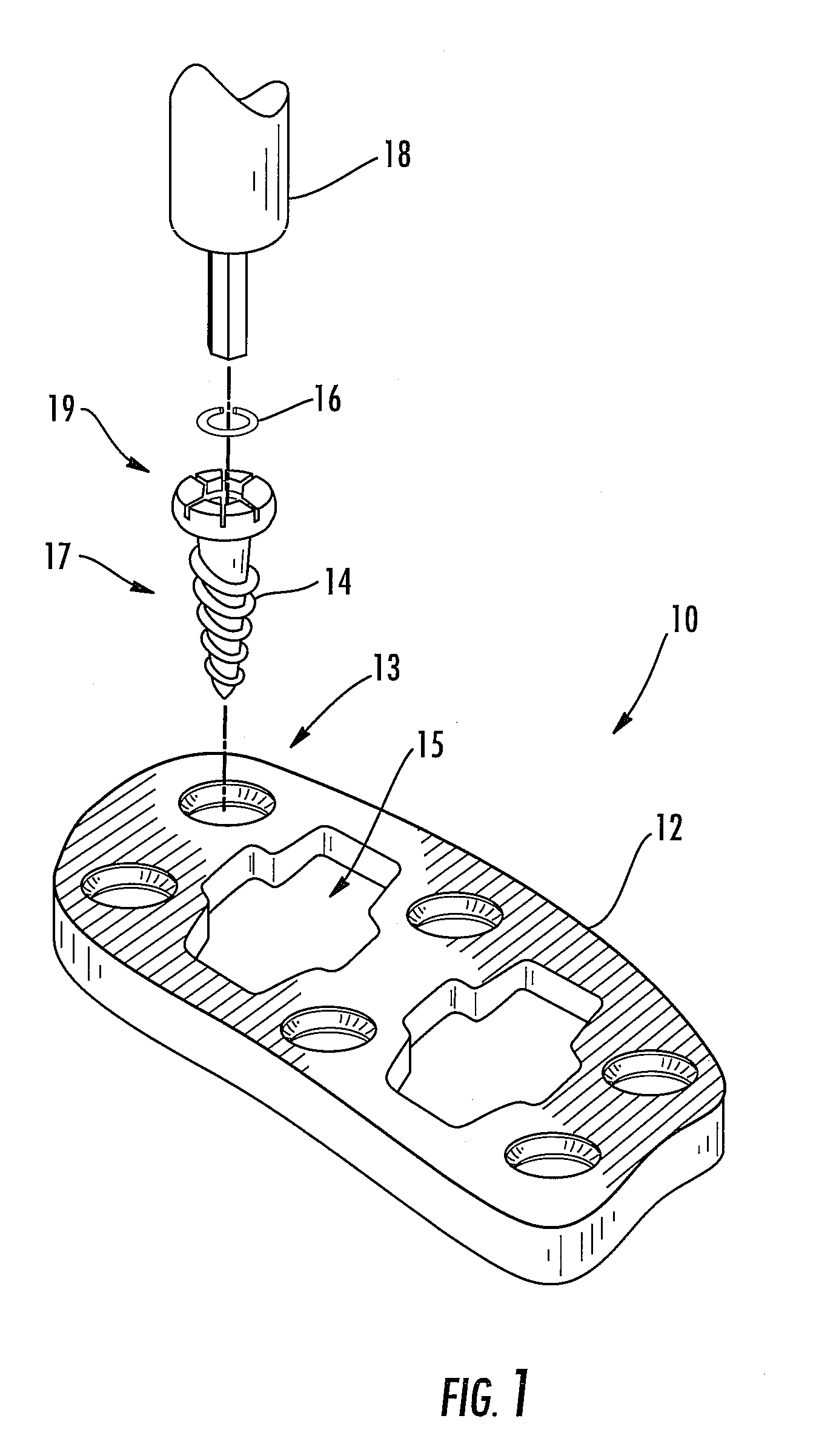 Cervical plate locking mechanism and associated surgical method