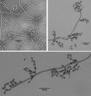 Culture medium for detecting population quantity of isaria cateinannulata in soil, and preparation method and use method of culture medium