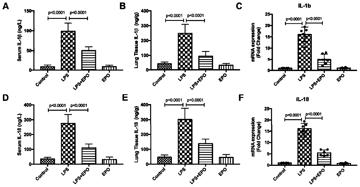 NLRP3 inflammasome inhibitor and application thereof