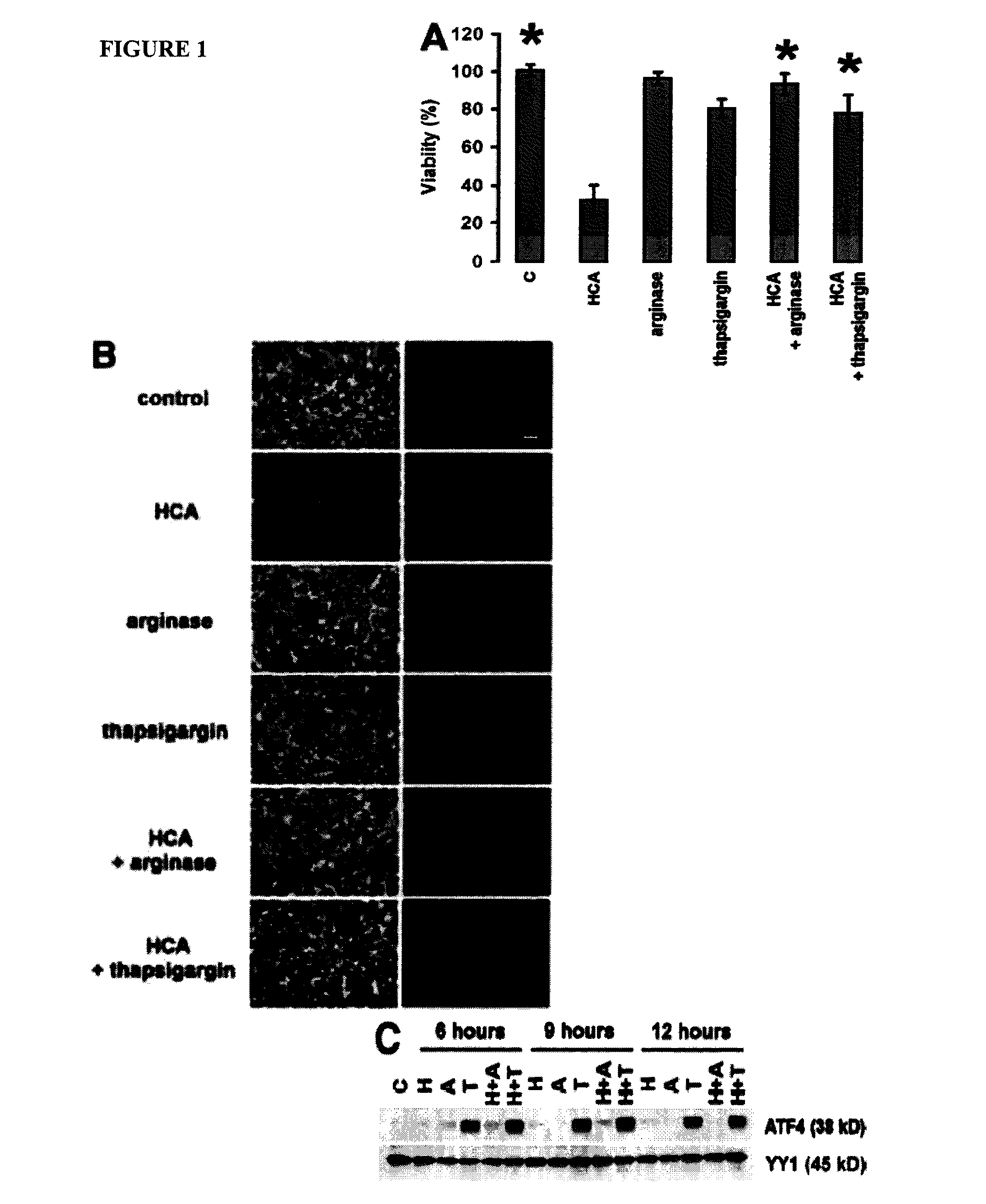 ATF4 Inhibitors and Their Use for Neural Protection, Repair, Regeneration, and Plasticity