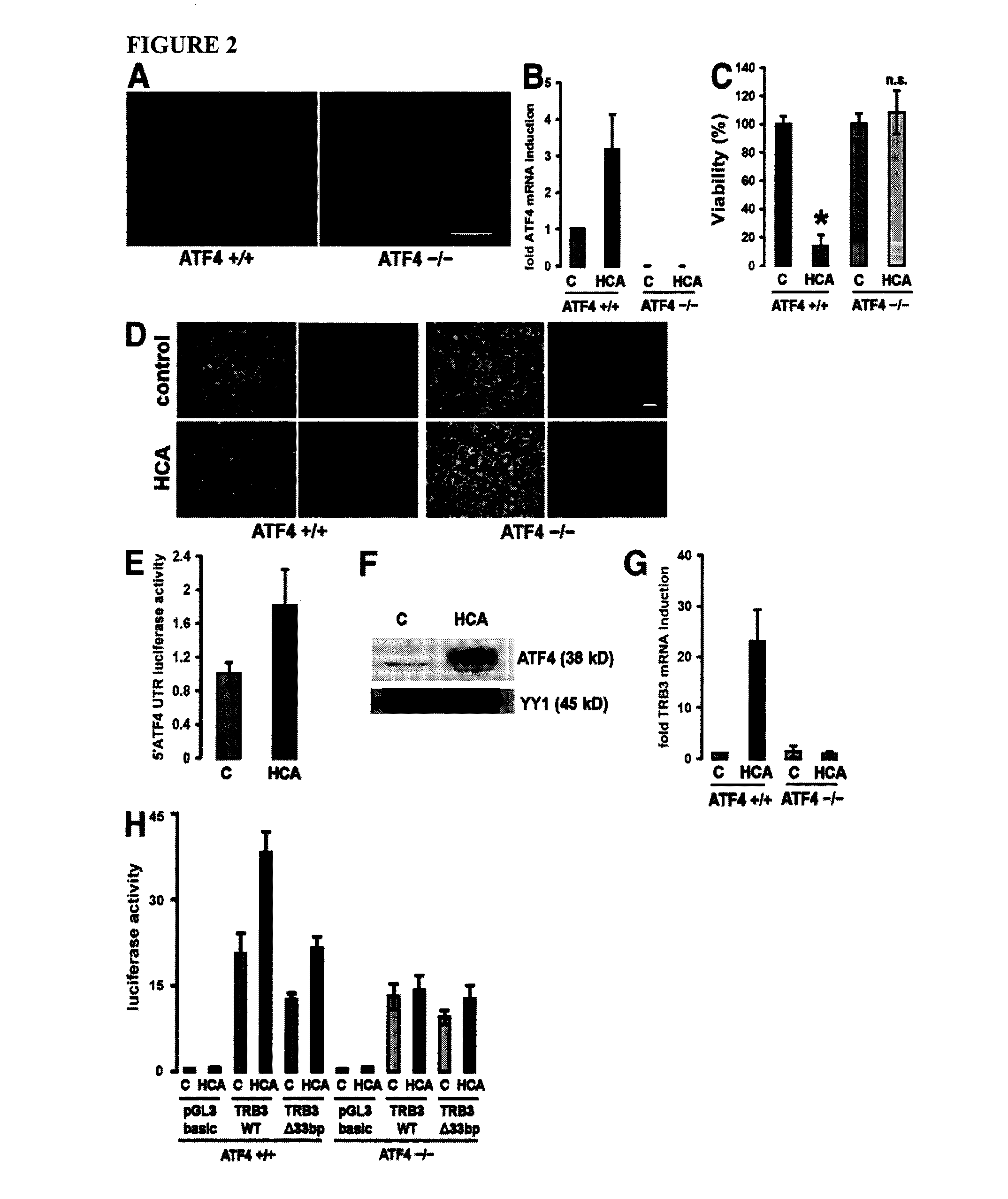 ATF4 Inhibitors and Their Use for Neural Protection, Repair, Regeneration, and Plasticity