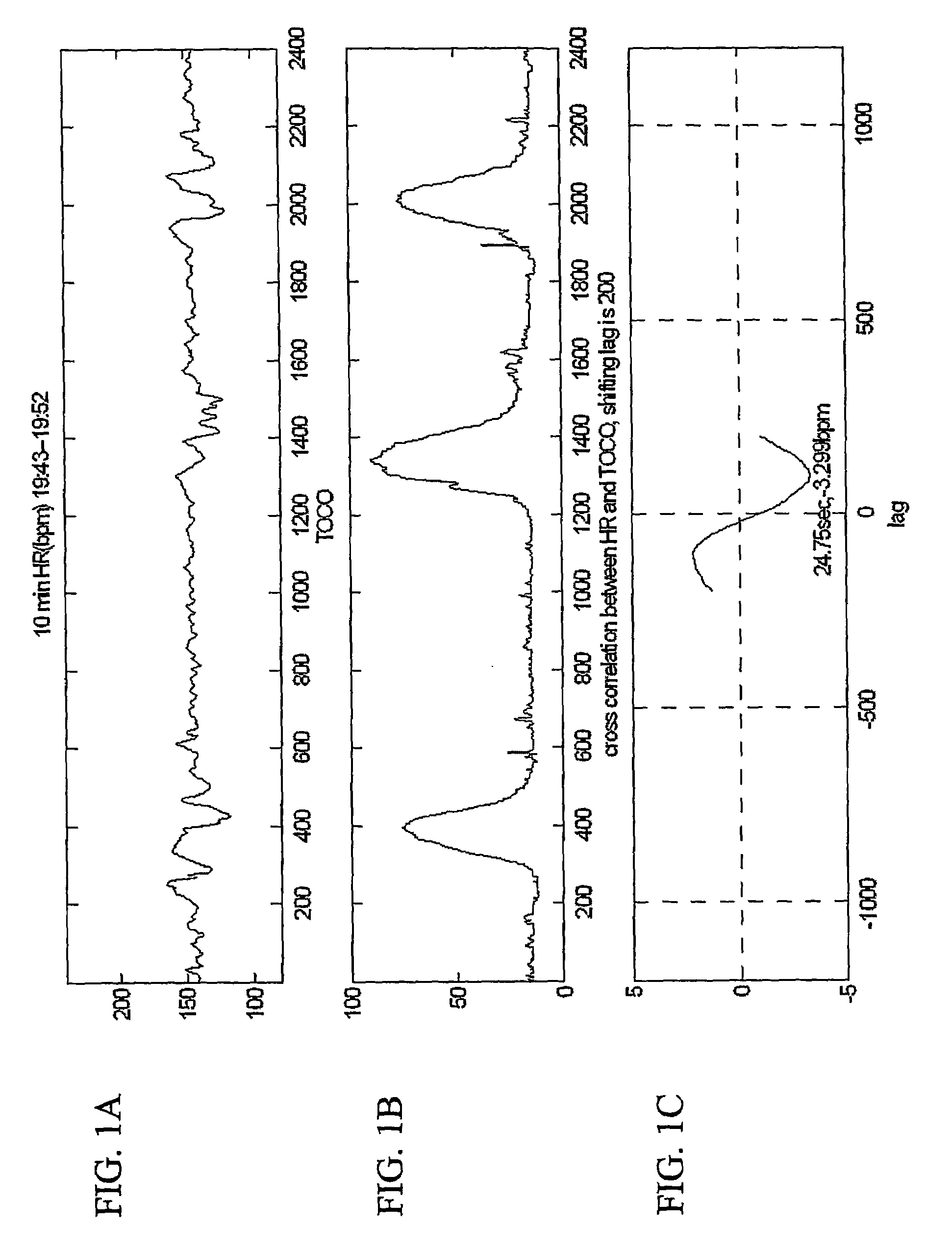 Quantitative fetal heart rate and cardiotocographic monitoring system and related method thereof