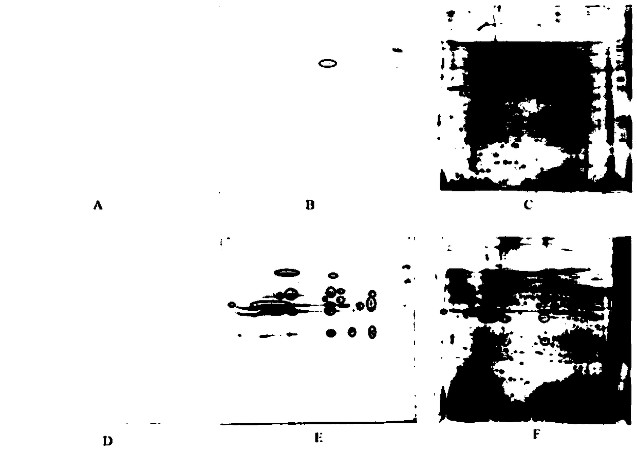 Babesia mocroti 2D97 antigen protein and application thereof