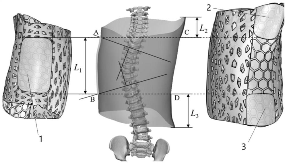 Orthosis device for scoliosis and manufacturing method thereof