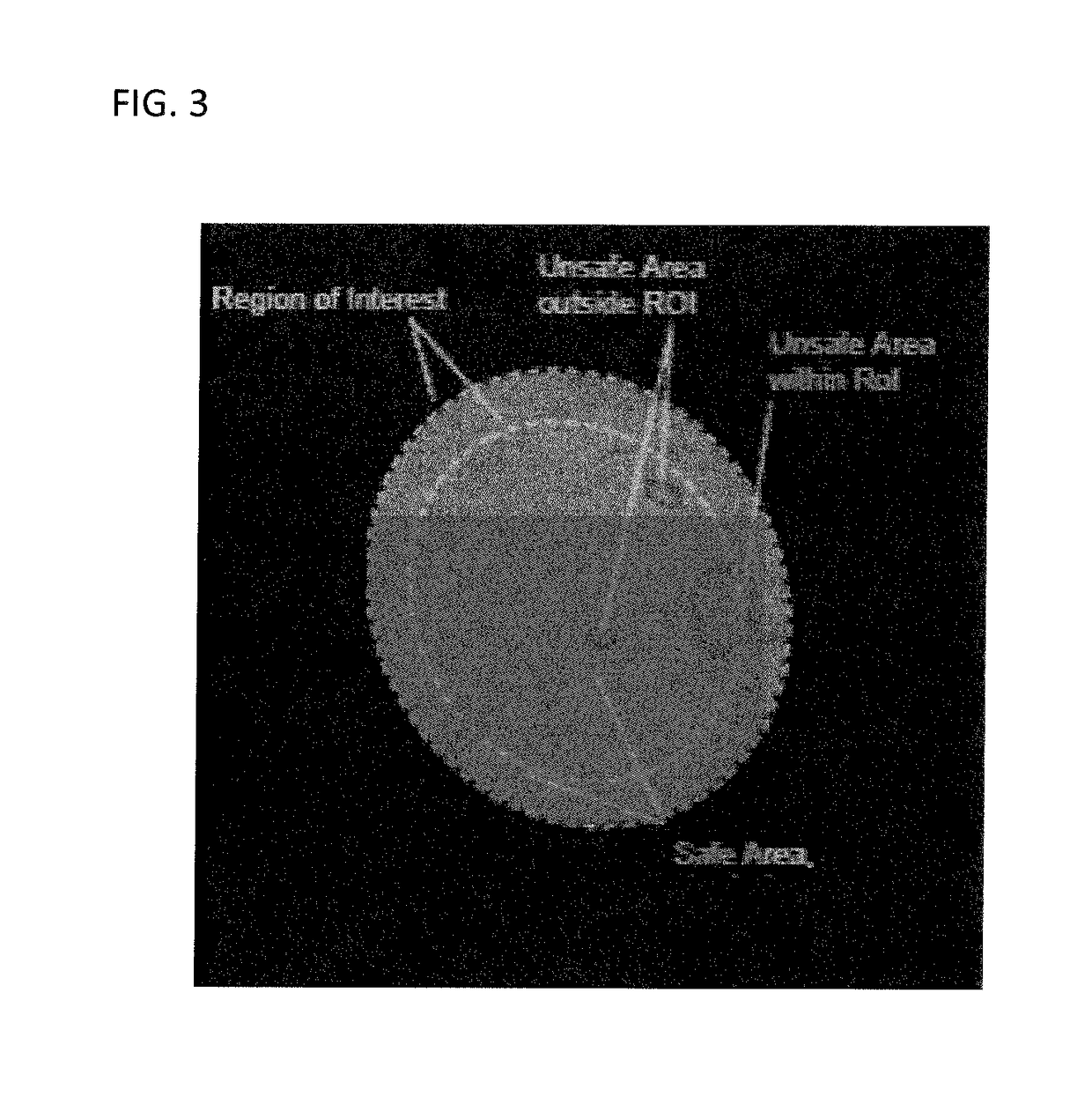 Apparatus for determining and quantifying the staining of ocular structures and method therefor