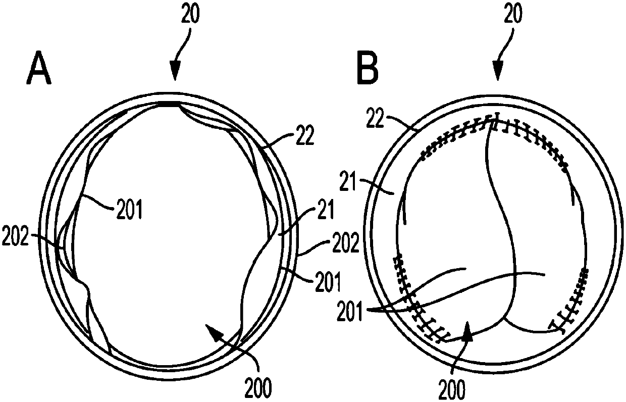 Valved conduit and method for fabricating same