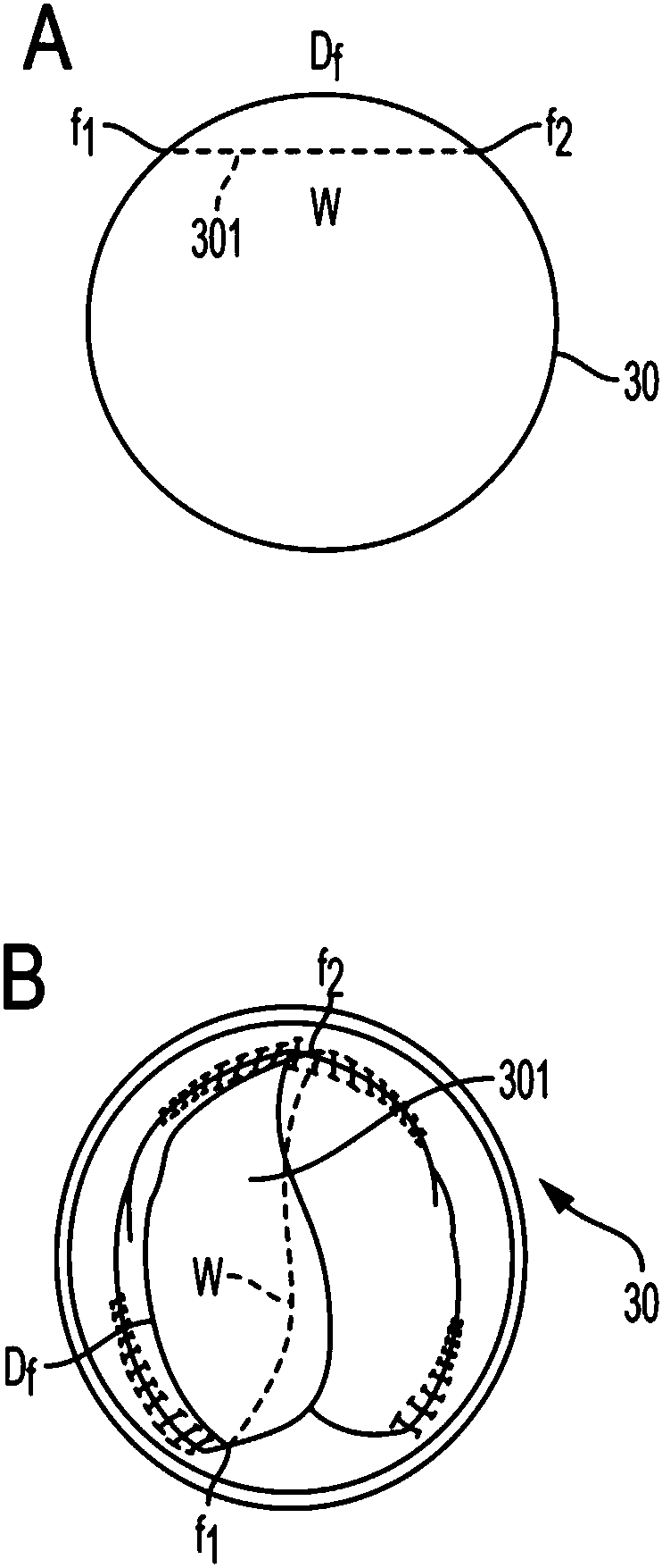 Valved conduit and method for fabricating same