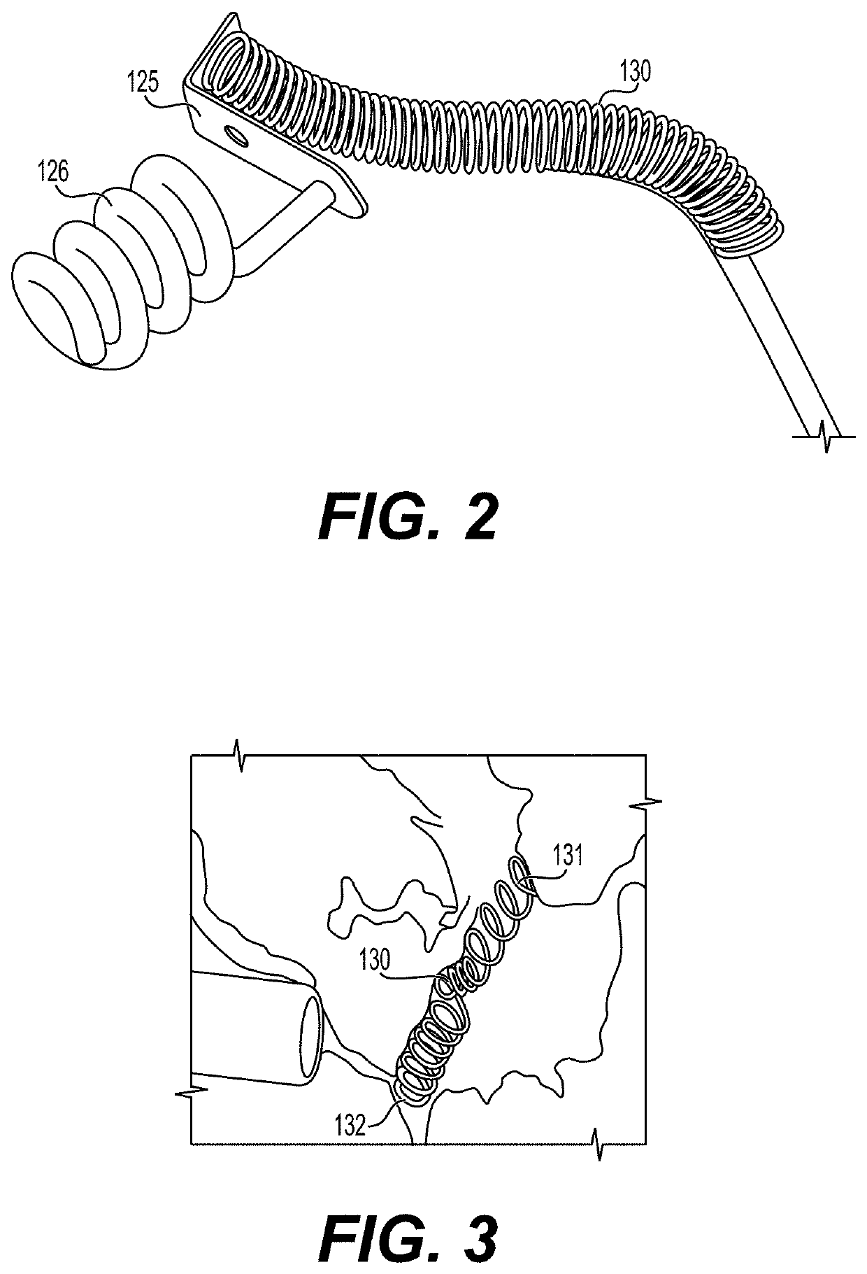 Implanted electrical lead for pacemaker