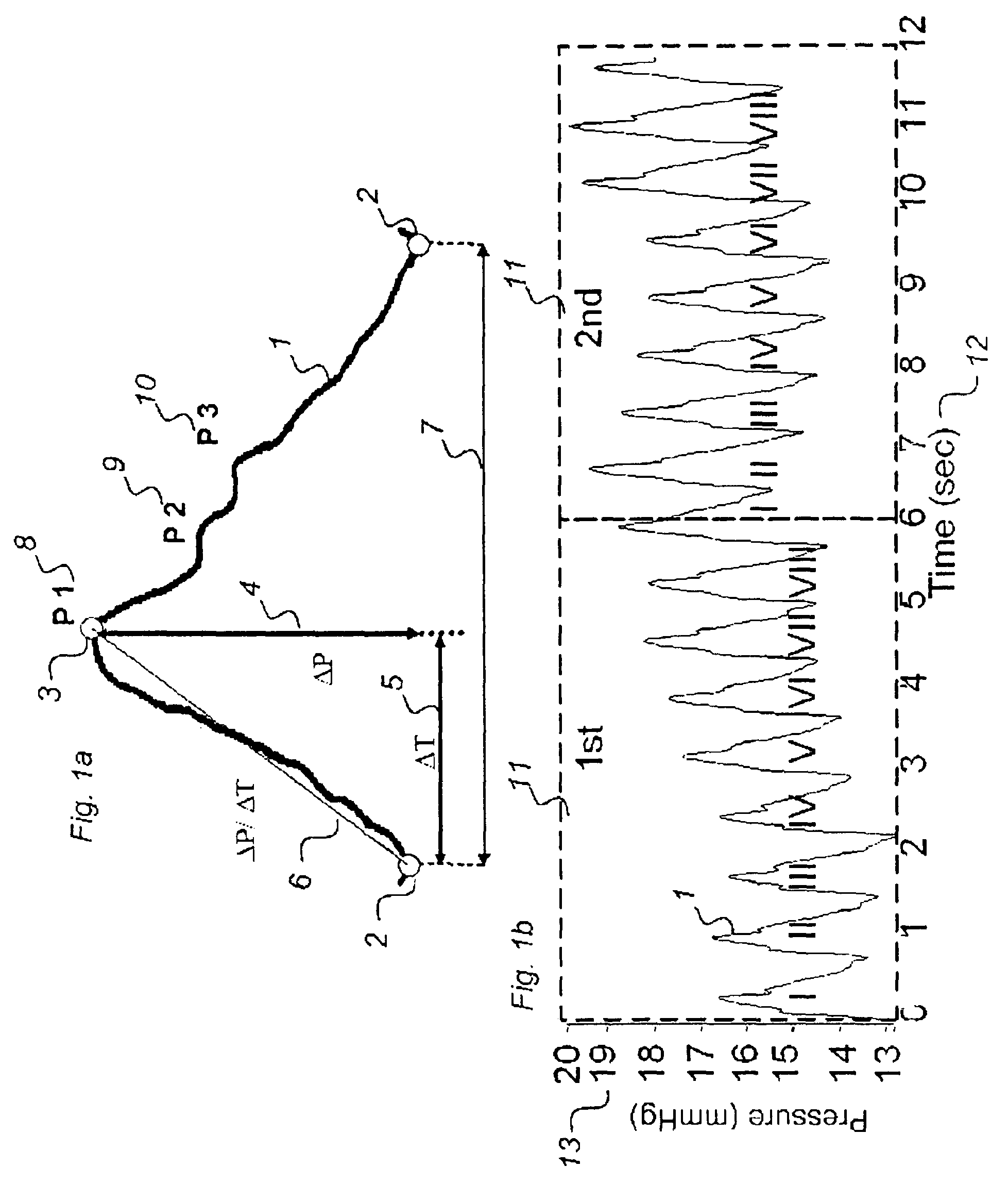 Method for analysis of single pulse pressure waves