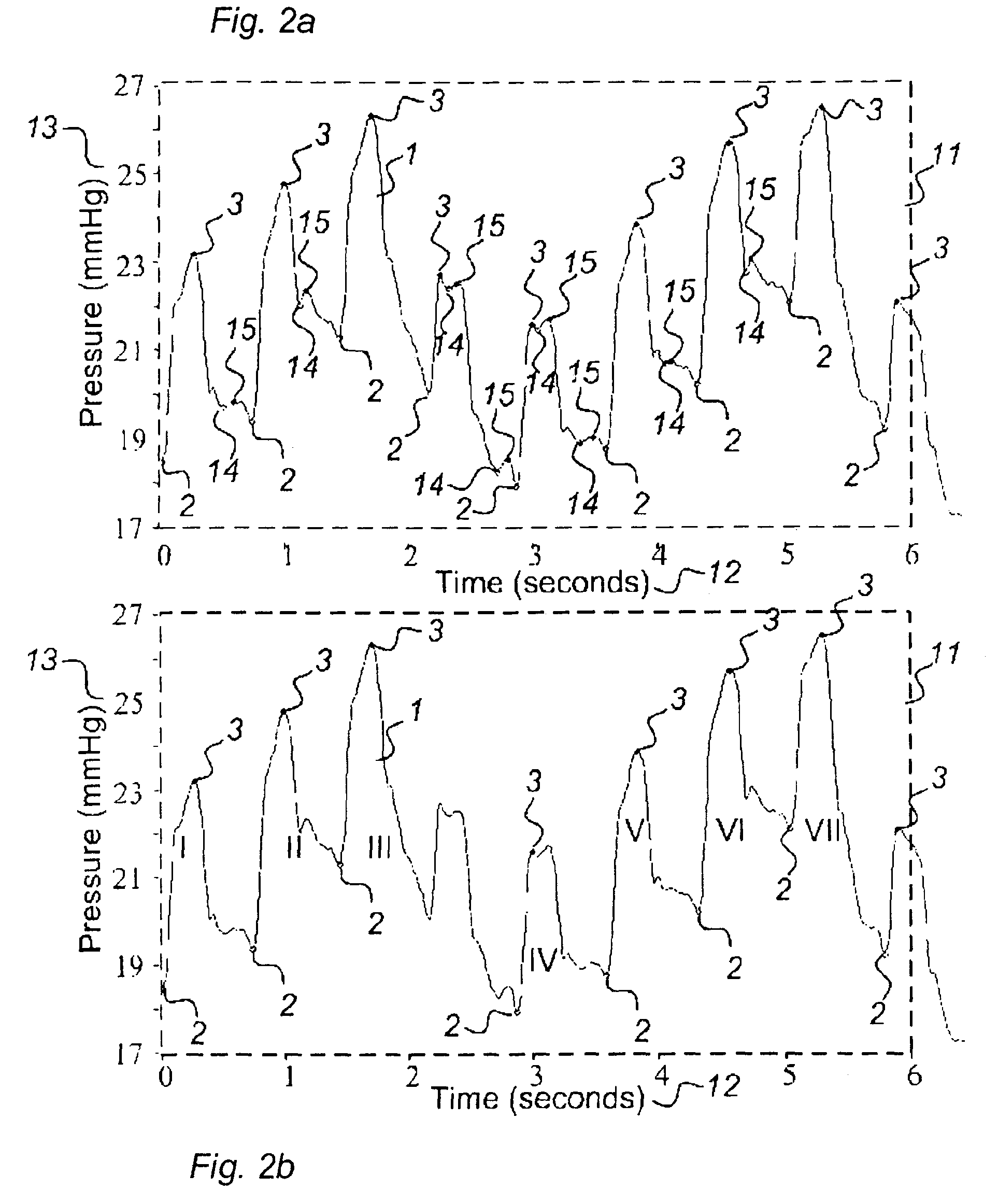 Method for analysis of single pulse pressure waves