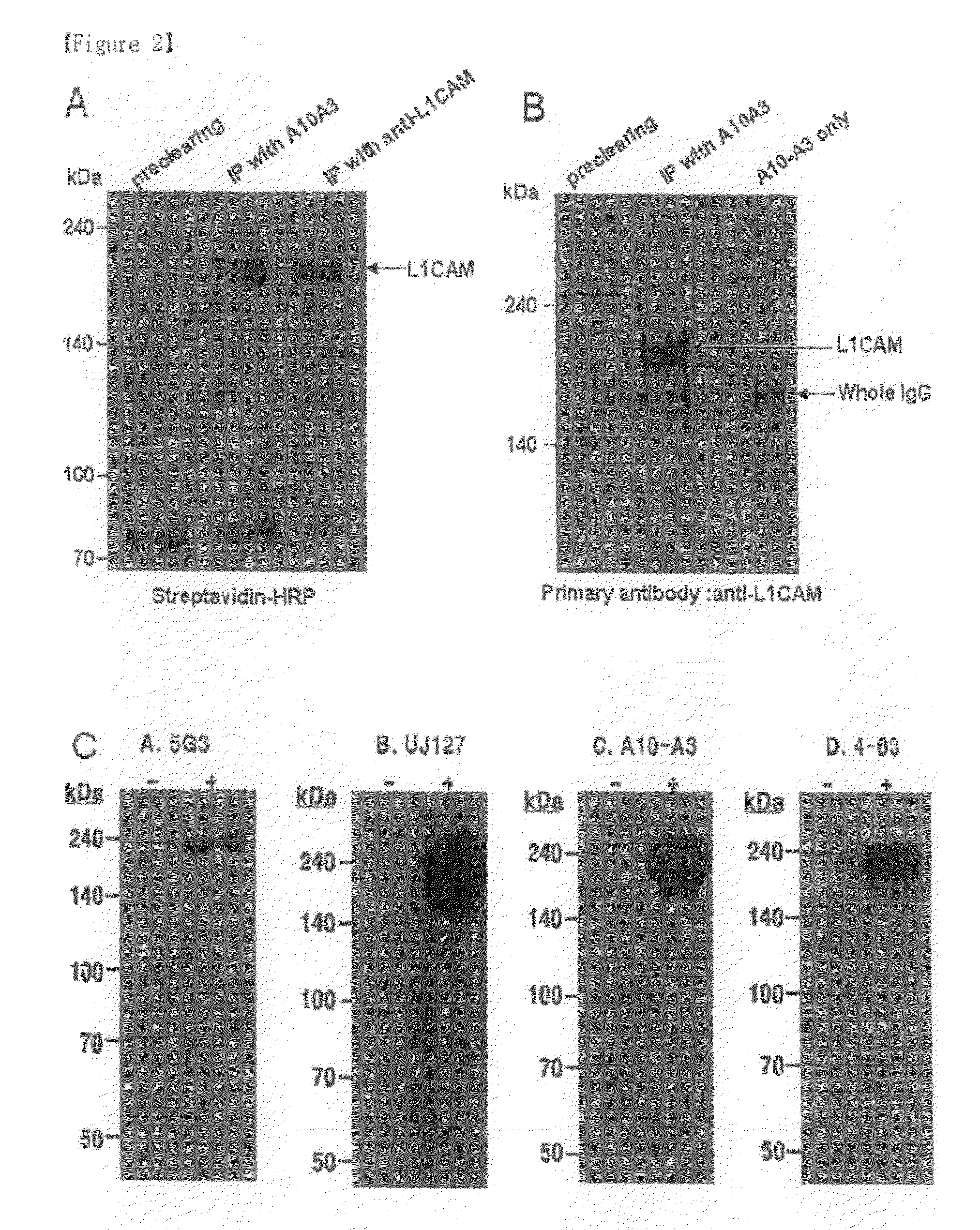 Pharmaceutical composition for treating cholangiocarcinoma, a method for inhibiting growth or invasion of cholangiocarcinoma and a method for treating cholangiocarcinoma