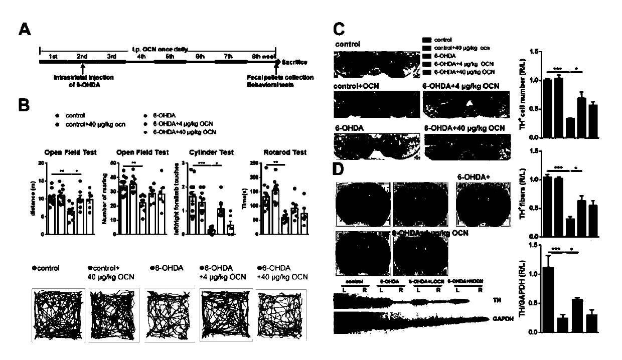 Application of osteocalcin or propanoic acid to preparation of anti-parkinson's disease drug