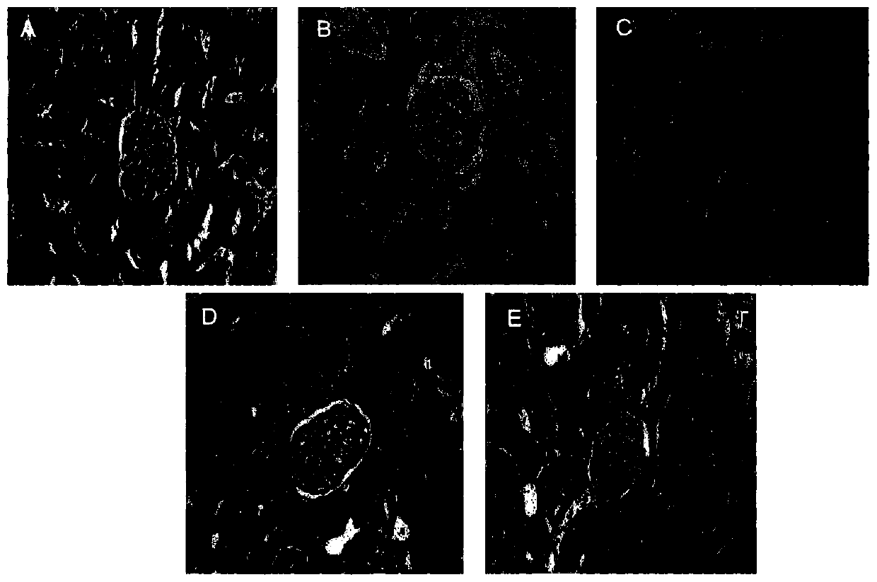 Application of andrographolide and preparation method of andrographolide rectal suppository