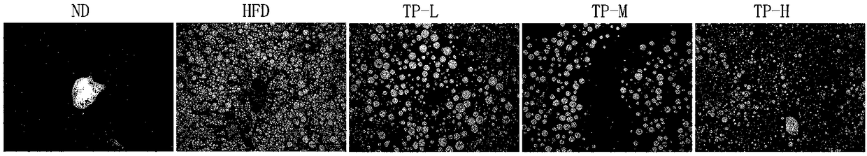 Application of tremella polysaccharides in preparation of medicines for preventing and controlling obesity