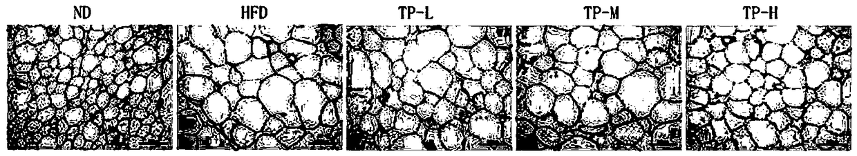 Application of tremella polysaccharides in preparation of medicines for preventing and controlling obesity