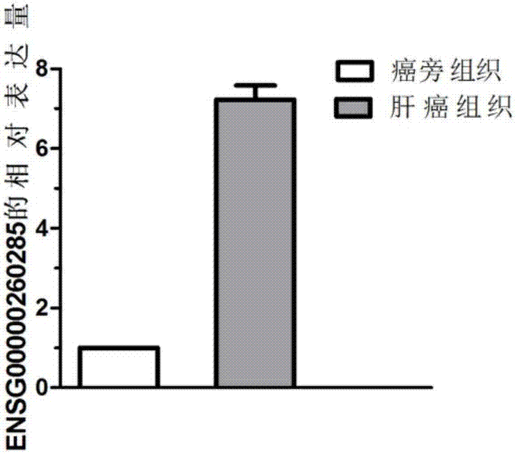 Gene related to liver cancer and application thereof