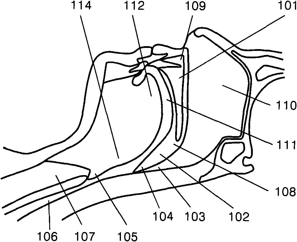 Adjustable soft palate supporting body and implantation method thereof