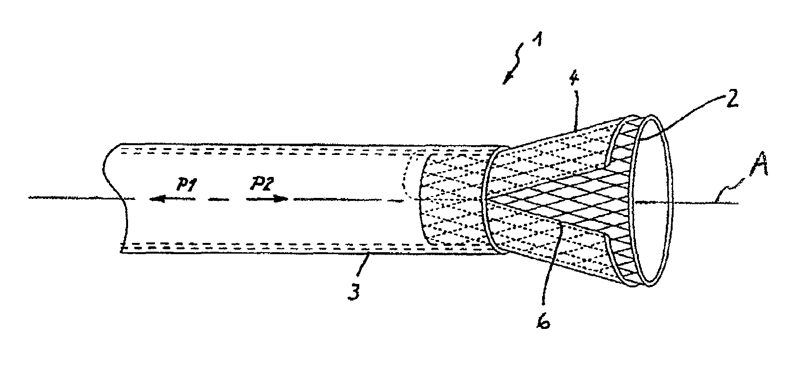 Instrument for implanting vascular prostheses