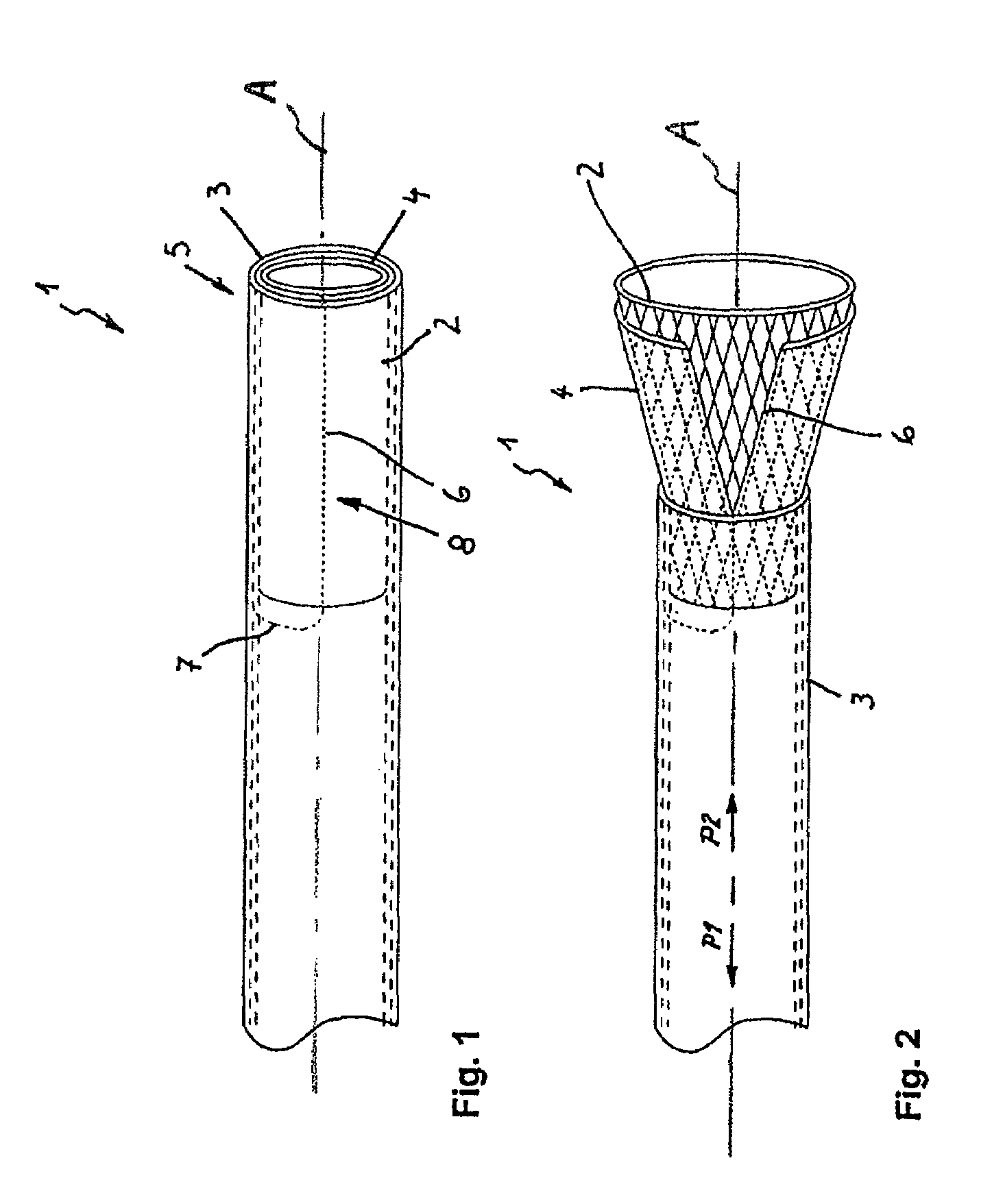 Instrument for implanting vascular prostheses