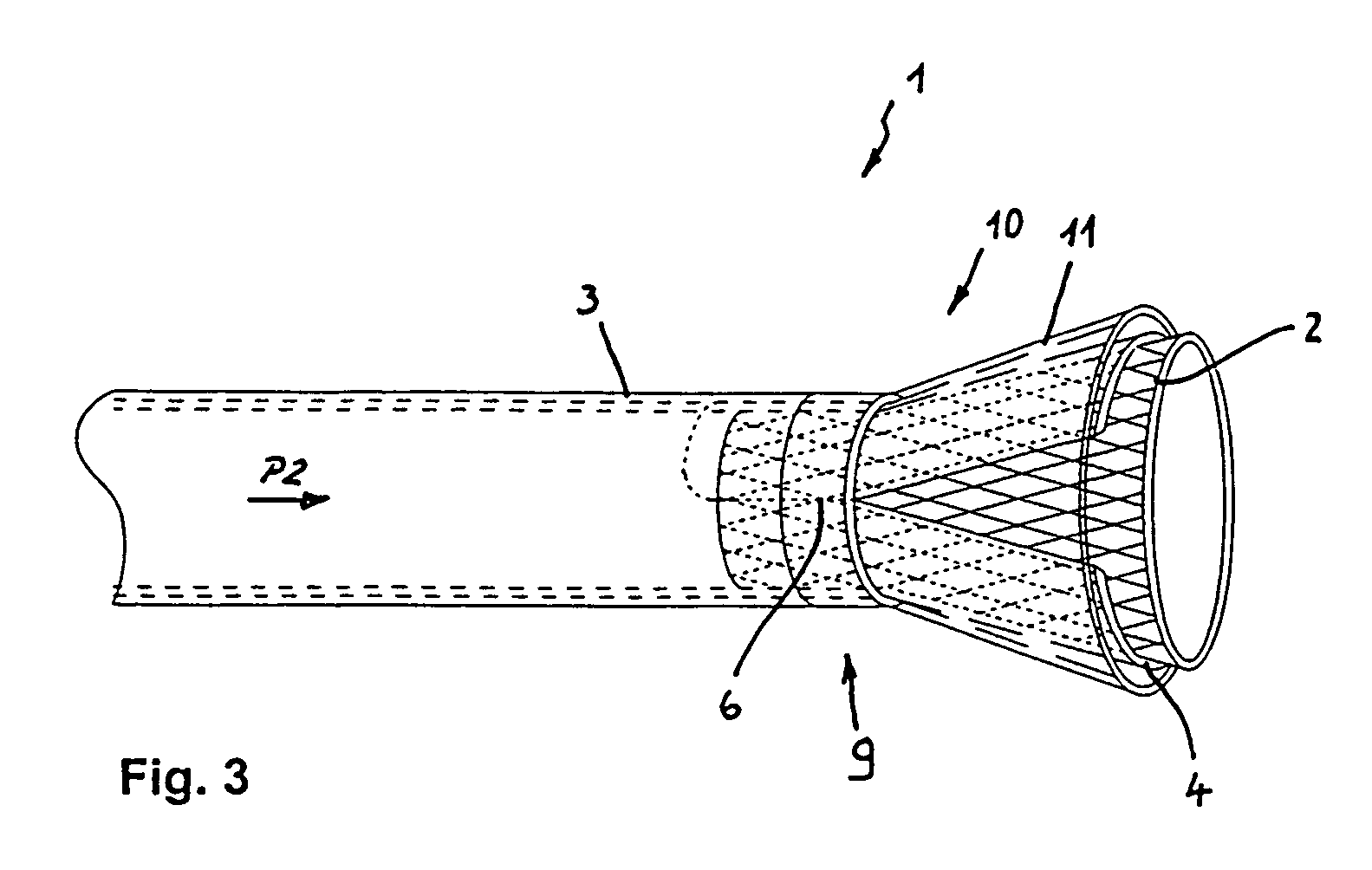 Instrument for implanting vascular prostheses