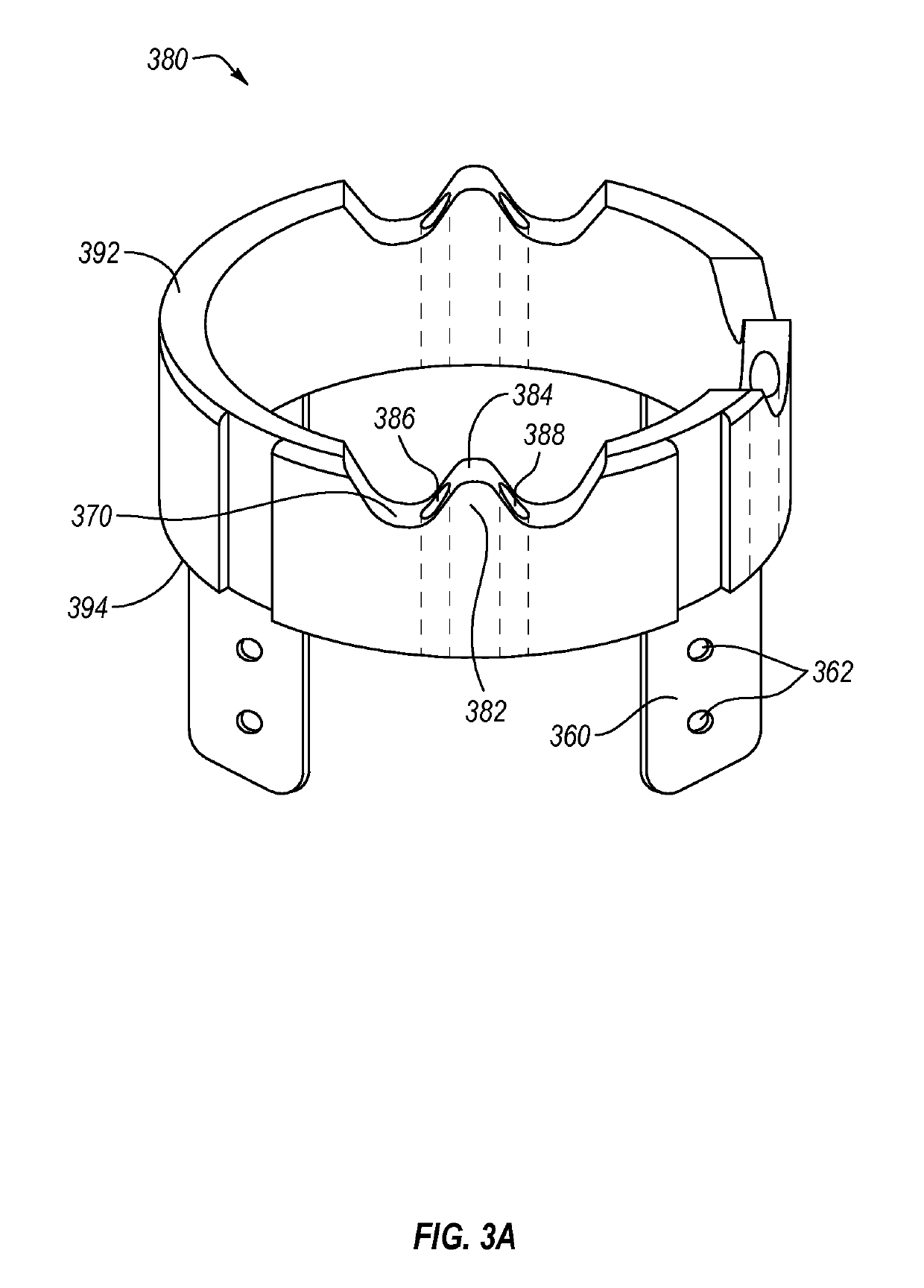 Catheter guiding system and methods