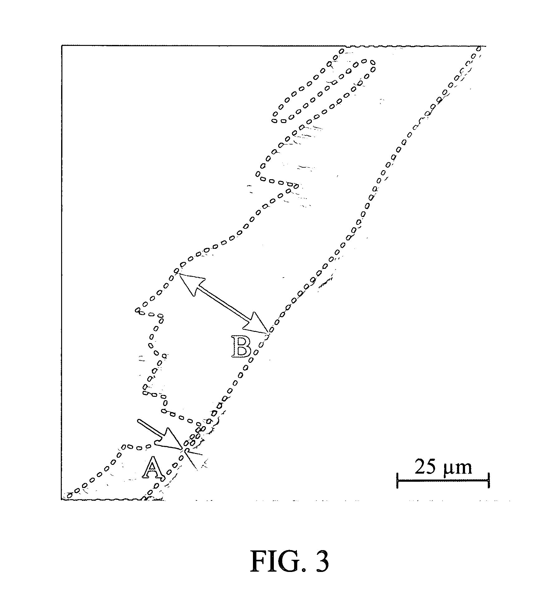 Method of infiltrating enamel lesions