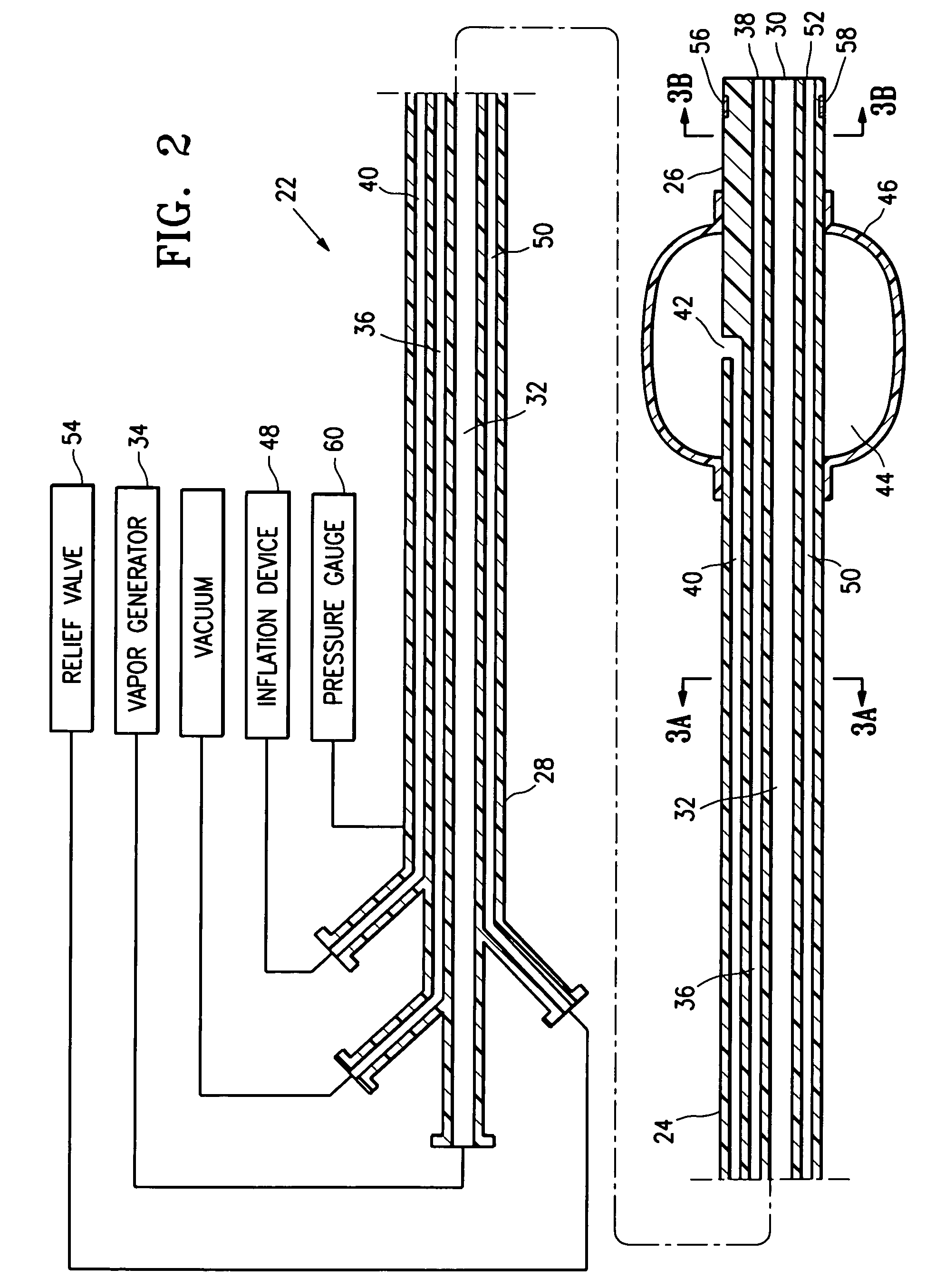 Device and method for lung treatment