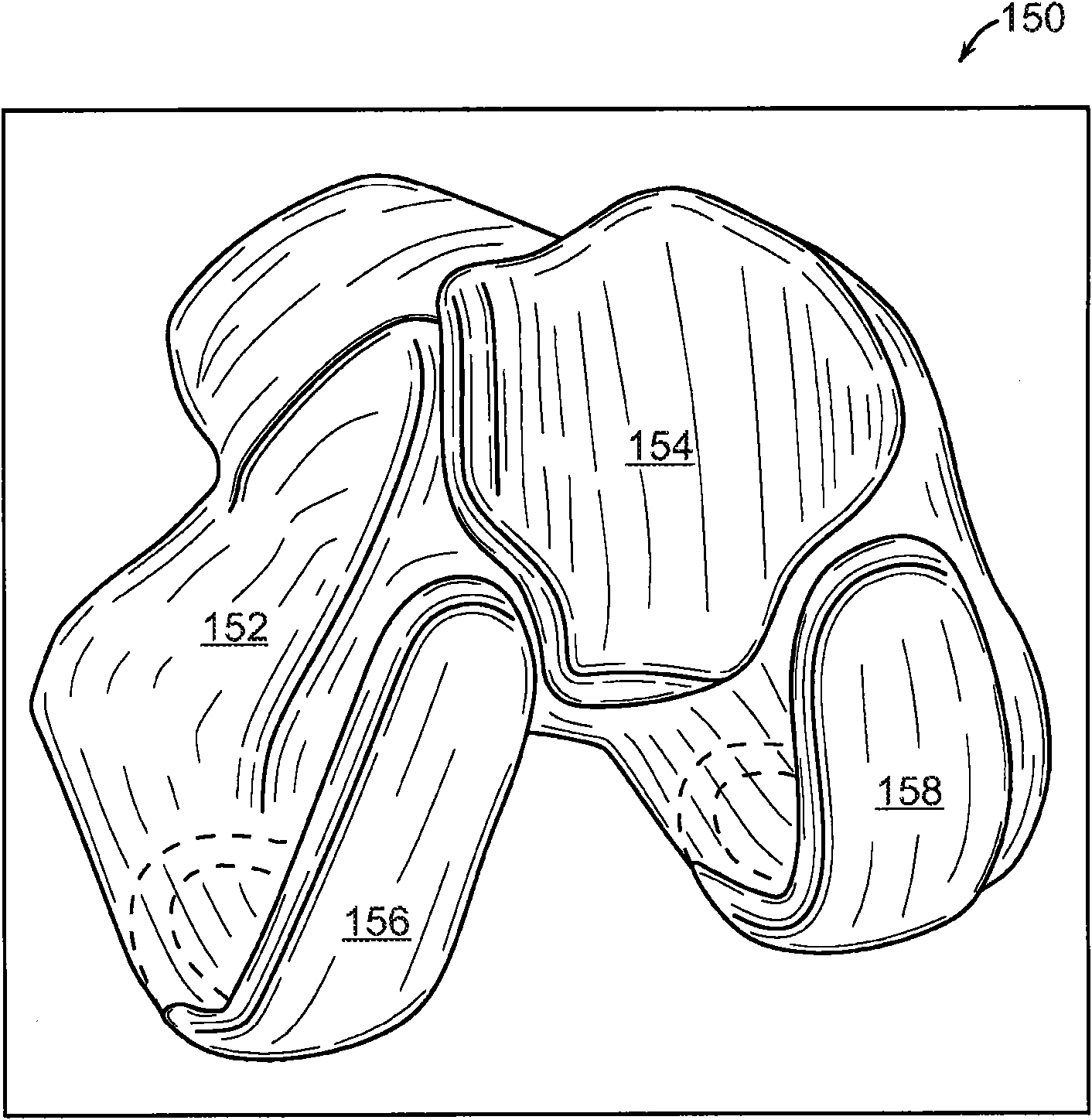 Implant planning for multiple implant components using constraints