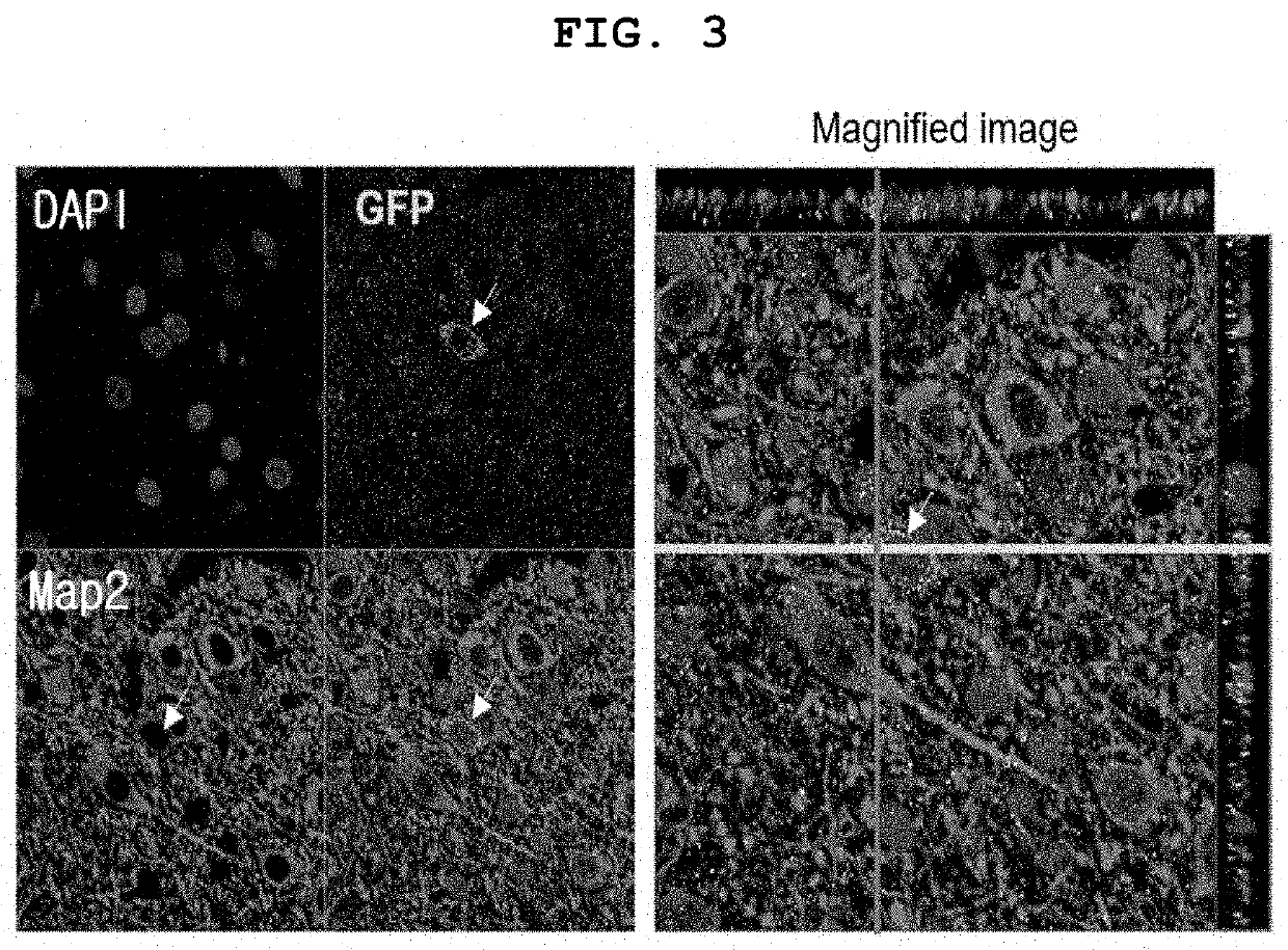 Adult Stem Cell Line Introduced with Hepatocyte Growth Factor Gene and Neurogenic Transcription Factor Gene with Basic Helix-Loop-Helix Motif and Uses Thereof